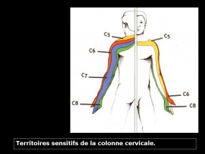 Les névralgies cervico brachiales Imagerie de l appareil locomoteur